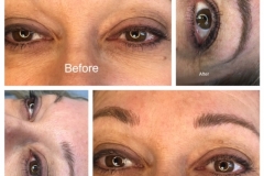 Permanent Eyebrows